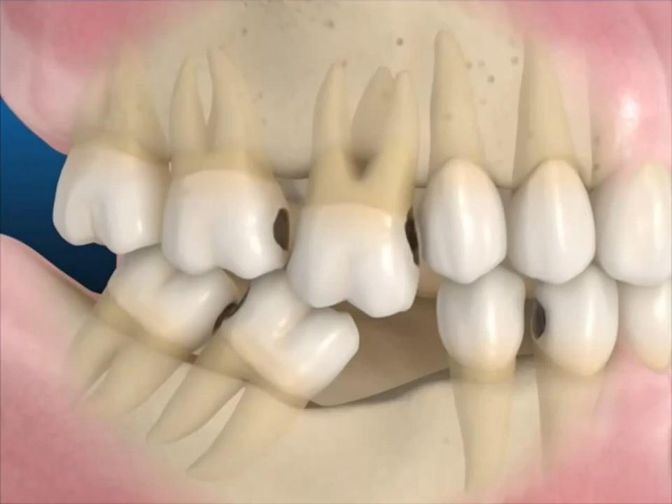 nha khoa thẩm mỹ 470 quận 3 - nơi được nhiều người tin tưởng và lựa chọn cho việc trồng răng implant