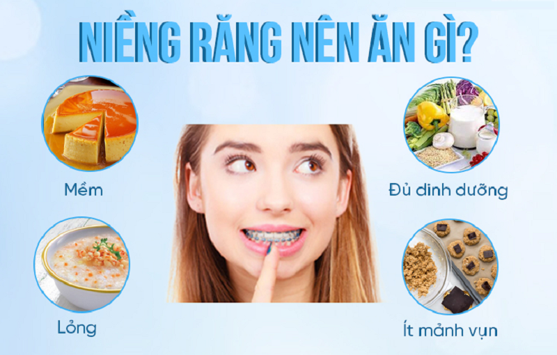 Niềng răng nên ăn gì để bảo vệ răng miệng?