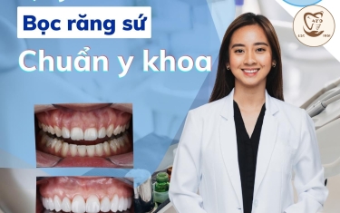 Quy trình bọc răng sứ chuẩn y khoa