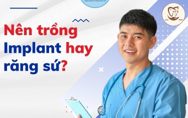 Nên làm răng sứ hay trồng implant?