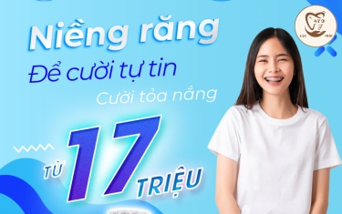 Niềng răng sẽ như thế nào?