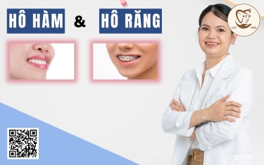 Cách phân biệt tình trạng hô răng và hô hàm chuẩn nhất