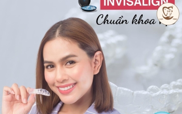 Quy trình niềng răng với khay trong suốt Invisalign