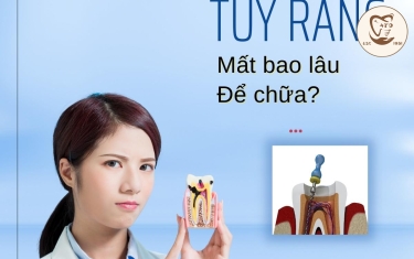 Điều trị tủy răng mất bao lâu và có nguy hiểm không?