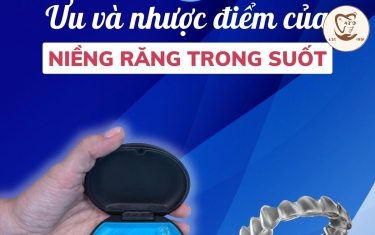 ưu và nhược điểm của Invisalign