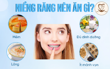 Niềng răng nên ăn gì?