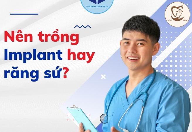 Nên làm răng sứ hay trồng implant?