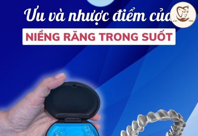 ưu và nhược điểm của Invisalign